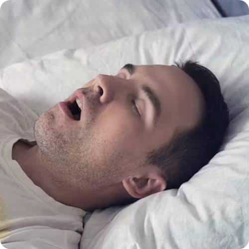 코골이 1